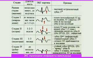Классификация инфаркта миокарда