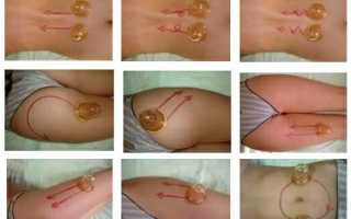 Баночный массаж от целлюлита: техника выполнения