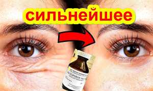 Эффективные рецепты масок от морщин вокруг глаз