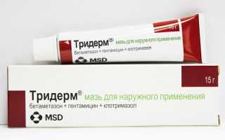 Сухость кожи: симптомы, причины, способы лечения