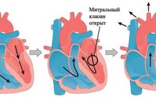 Пролапс митрального клапана лечение