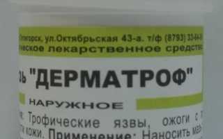 Лечение трофической язвы нетрадиционной медициной — лекарственные растворы и гомеопатия