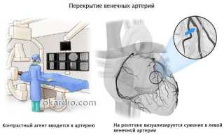 Каранарка сердца что это