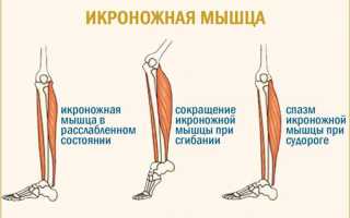 Судороги при беременности: причины и последствия