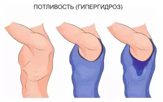 Повышенная потливость: причины особенностей организма