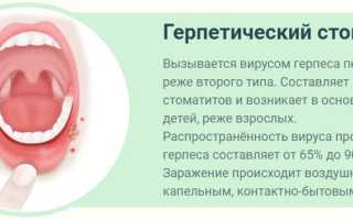 Лечение стоматита у взрослых – искореняем проблему