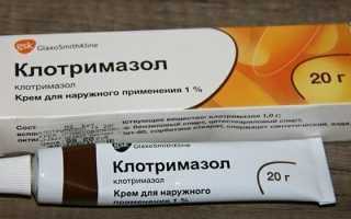 Как выбрать недорогое и эффективное средство от грибка ногтей на ногах