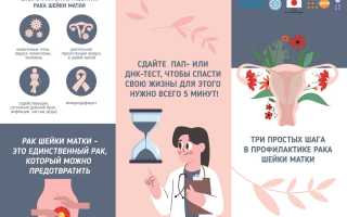 Заболевания шейки матки: как предупредить?
