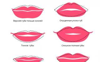 Увеличение объема губ — возможные методы