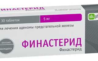 Андрогенная алопеция: причины, симптомы и лечение