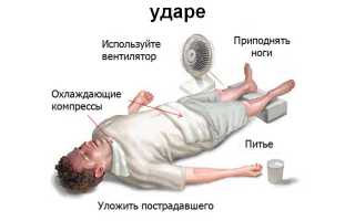 Первая помощь при солнечном ударе – что следует предпринять