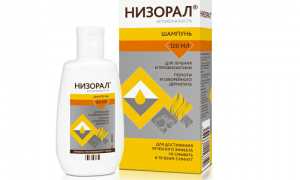 Почему выпадают волосы на голове у девушек и как с этим бороться?