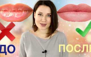 Сухие губы – как справиться с проблемой быстро и недорого