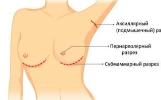 Увеличение груди в домашних условиях — все за и против