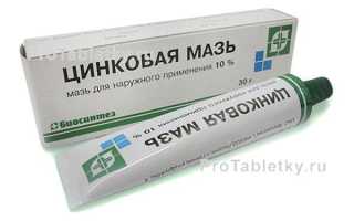 Цинковая мазь — простая, но эффективная помощь коже