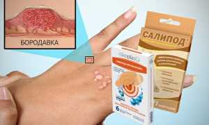 Удаление папиллом в домашних условиях: самые эффективные способы