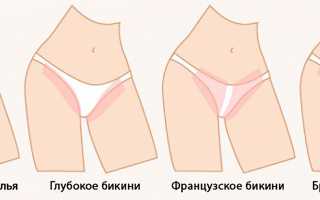 Бразильская эпиляция – пикантная процедура