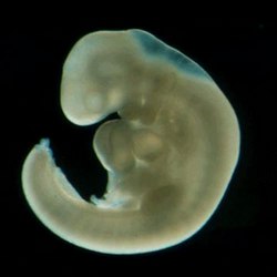 Фото по теме 4 неделя беременности: как проходит для девушки