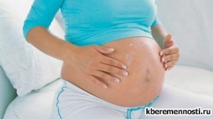 Фото по теме Как избежать растяжек во время беременности?