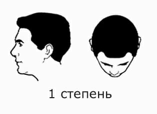 1 ÑÑÐµÐ¿ÐµÐ½Ñ