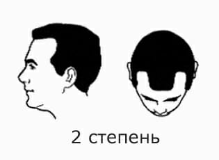 2 ÑÑÐµÐ¿ÐµÐ½Ñ