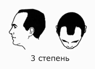 3 ÑÑÐµÐ¿ÐµÐ½Ñ