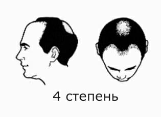 4 ÑÑÐµÐ¿ÐµÐ½Ñ