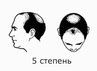 5 ÑÑÐµÐ¿ÐµÐ½Ñ