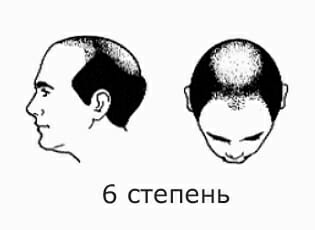 6 ÑÑÐµÐ¿ÐµÐ½Ñ