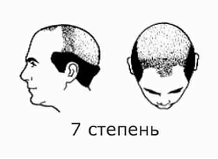 7 ÑÑÐµÐ¿ÐµÐ½Ñ